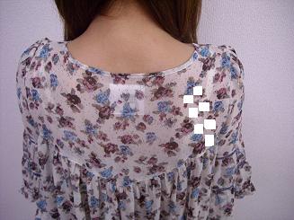 中央区の六本松整体で復活です。
