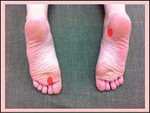 0代女性お客様の不調箇所2