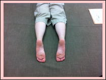 30代女性お客様の不調箇所1