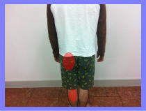 20代男性お客様の不調箇所2